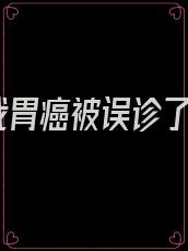 我胃癌被误诊了
